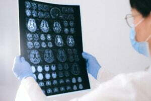 Doctor looking at multiple brain scans