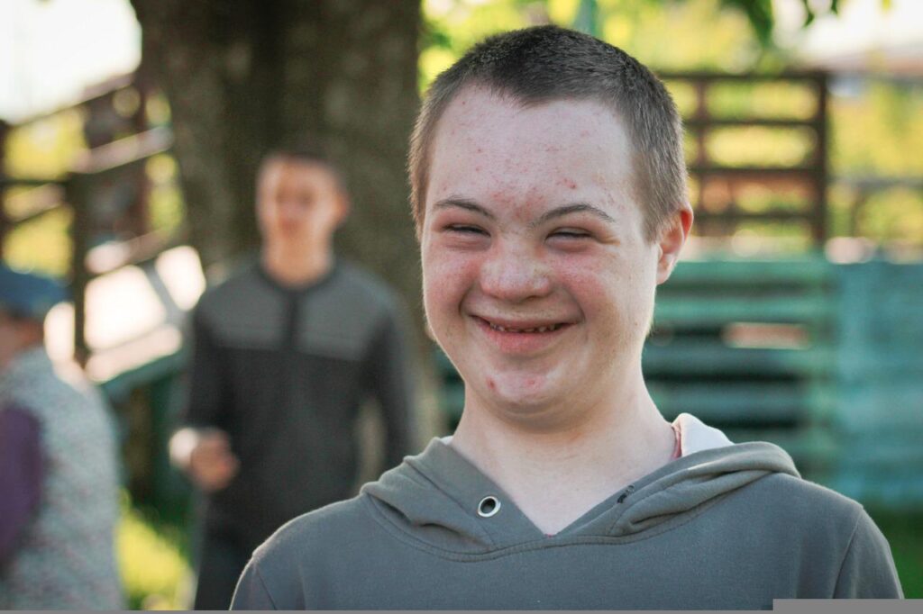 Boy downs syndrome