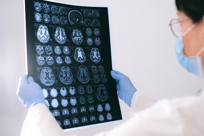Brain scans